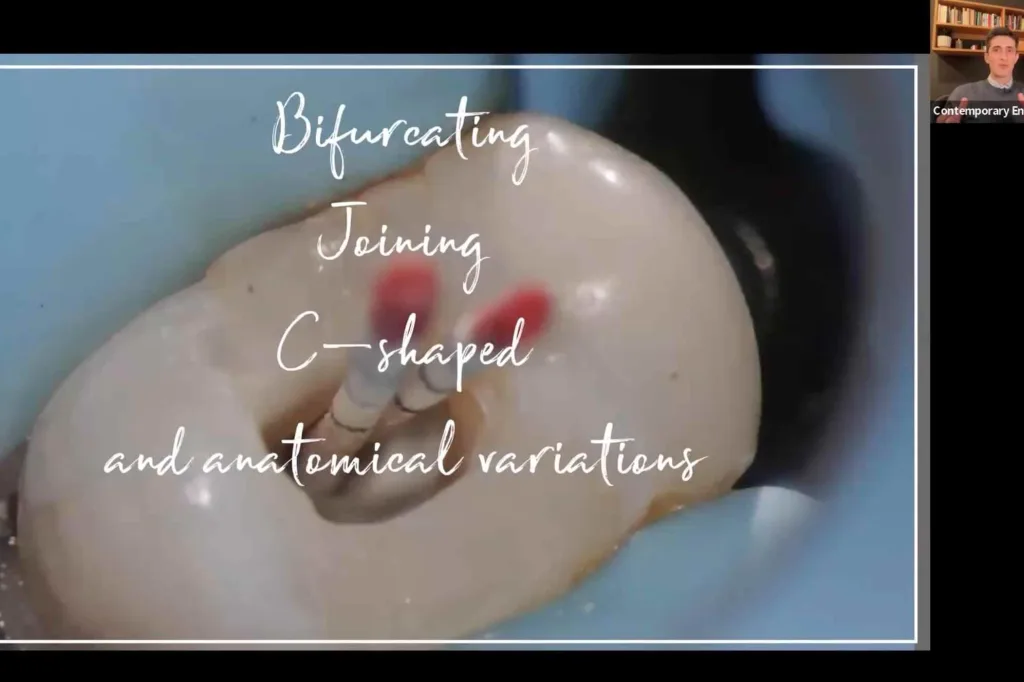 Managing complex anatomy thumbnail