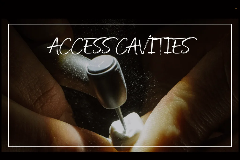 Access cavities