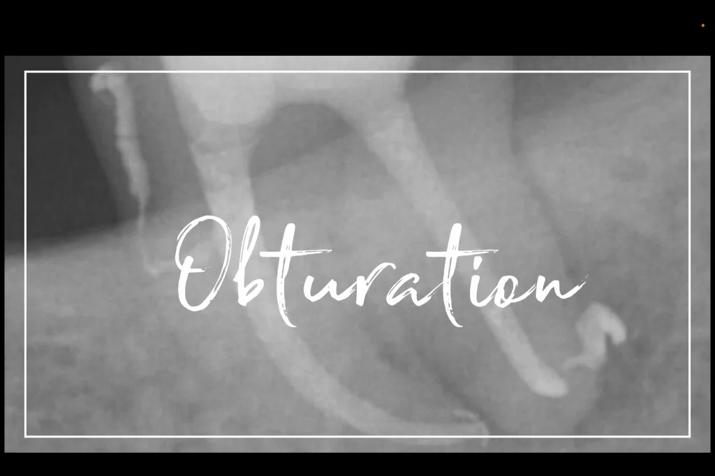Obturation