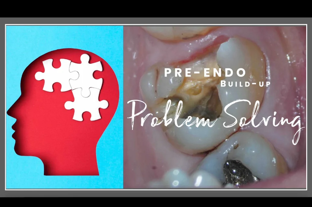 Pre endodontic buildup thumbnail