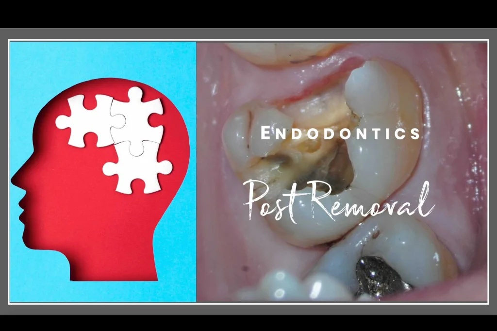 Post removal thumbnail