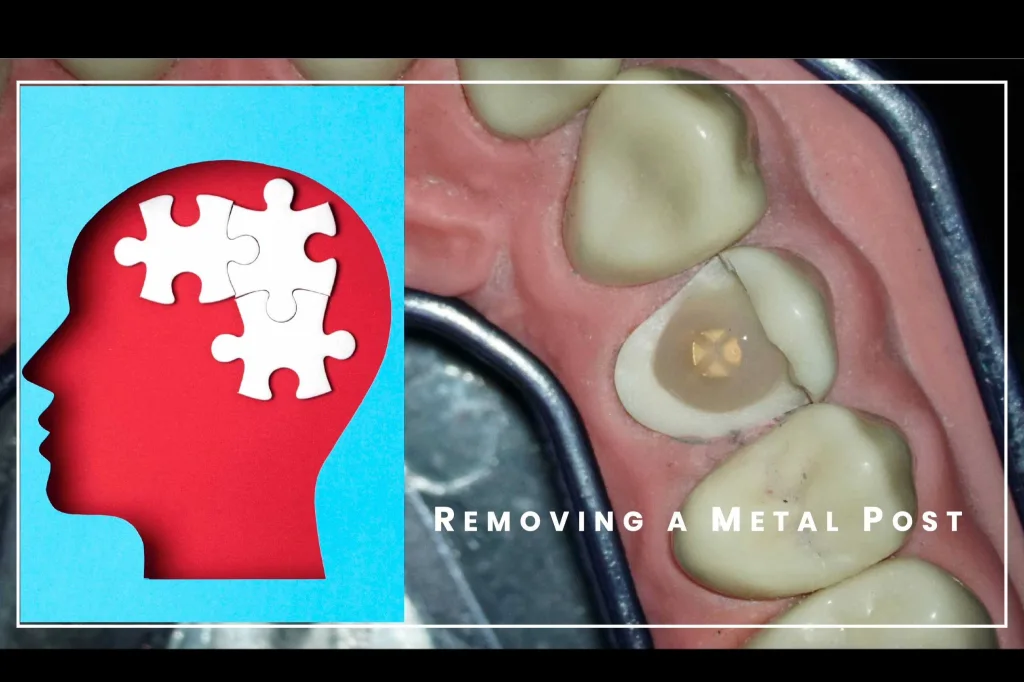 Post removal practical thimbnail