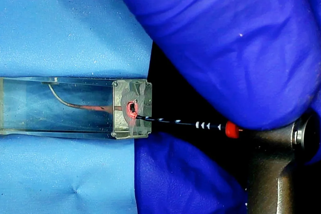 Thermafil removal reciproc blue thumbnail