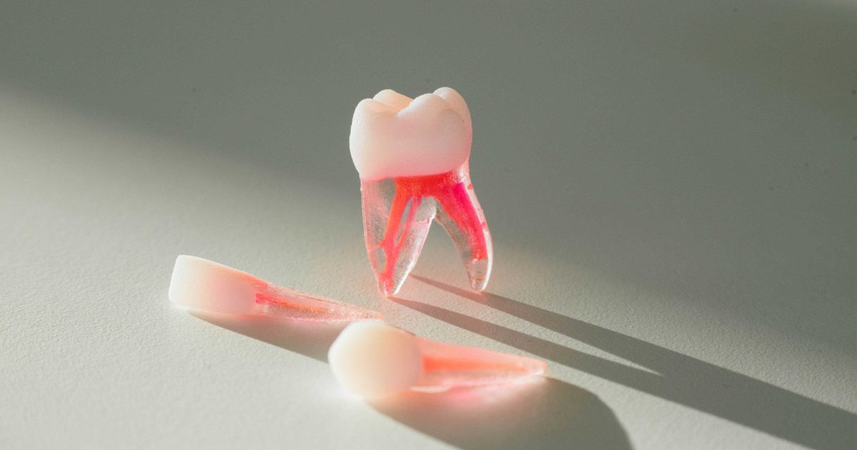 Advanced problem solving | Contemporary Endodontics